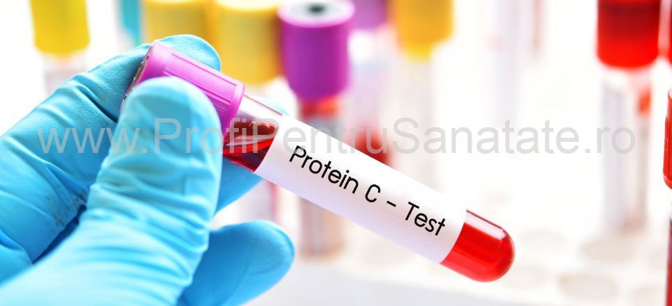 Articole Proteina C reactiv: valori normale i cauze ale valorilor  crescute | Cumpr online | Profi Pentru Sntate SRL