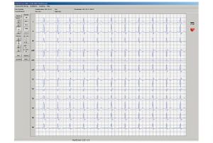 Innobase - Software şi interfaţă PC pentru electrocardiografe, testare la efort, monitoare ATI