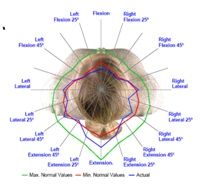 MCU - sistem de recuperare cervicală cu posibilităţi multiple