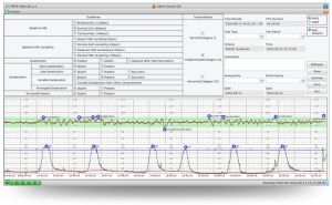 MFM-CNS (Ethernet) - Staţie de monitorizare fetală prin conexiune ethernet