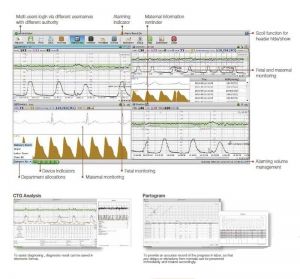 MFM-CNS (Ethernet) - Staţie de monitorizare fetală prin conexiune ethernet