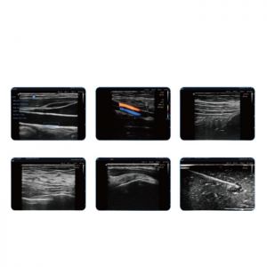 Ecograf ultraportabil wireless convex Nano C5 EXP