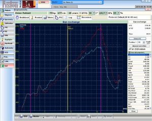 Ergospirometru computerizat (CPET) - PRE-201/cc