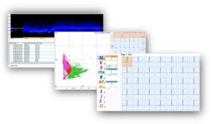 SA-20 Sistem Holter ECG şi TA EDAN 